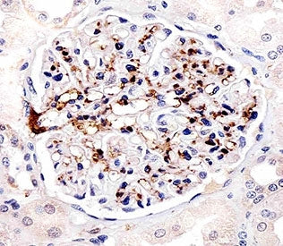 FABP4 Antibody
