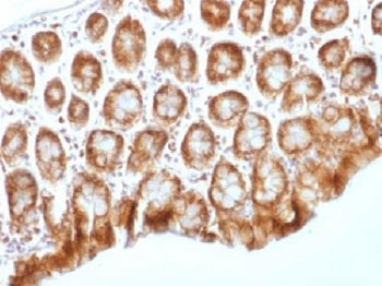 Beta Catenin Antibody