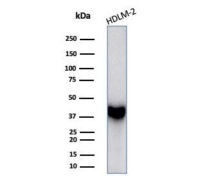 Western blot testing of human HDLM-2 cell lysate with STING1 antibody (clone STING1/7435). Predicted