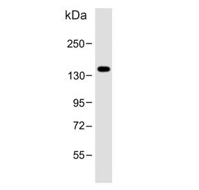 Western blot testing of human LNCaP cell lysate with POTE2 antibody. Predicted molecular weight ~121