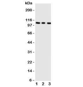 Western blot testing of ADAMTS1 antibody; Lane 1: rat liver; 2: (r) heart; 3: (r) brain tissue lysat