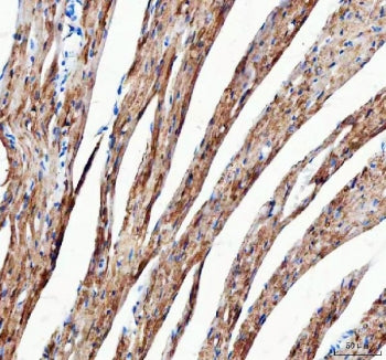IHC staining of FFPE mouse heart tissue with Mitofilin antibody. HIER: boil tissue sections in pH8 E