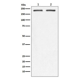 Western blot testing of 1) human SW480 and 2) mouse spleen lysate with CD104 antibody. Predicted mol