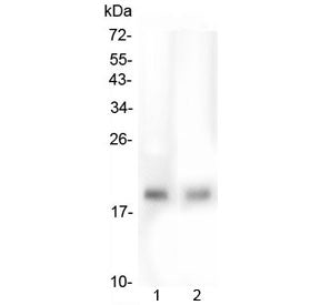 Western blot testing of human 1) HepG2 and 2) PC-3 lysate with TMEM166 antibody at 0.5ug/ml. Predict
