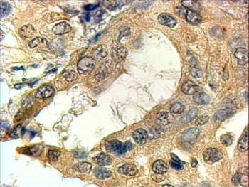 IHC testing of FFPE human prostate with SRD5A1 antibody at 4ug/ml. HIER: steamed with pH9 Tris/EDTA 