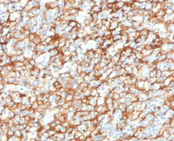 IHC staining of FFPE human tonsil tissue with CD73 antibody (clone CDLA73-1). HIER: boil tissue sect