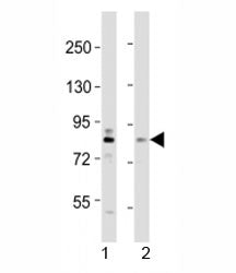 Western blot testing of DYRK1A antibody at 1:2000 dilution. Lane 1: mouse brain lysate; 2: HeLa lysa