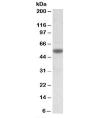 Western blot testing of KELLY cell lysate with CHRNA5 antibody at 1ug/ml. Predicted molecular weight
