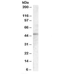 Western blot testing of A431 cell lysate with TMPRSS3 antibody at 0.1ug/ml. Predicted molecular weig