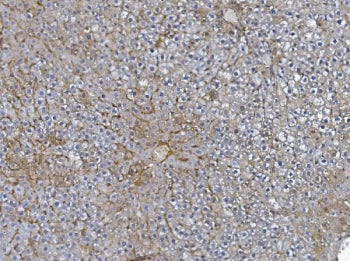 IHC staining of FFPE rat liver with Afm antibody. HIER: boil tissue sections in pH8 EDTA for 20 min 
