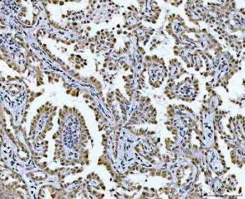 GLIS1 Antibody / GLI-similar 1