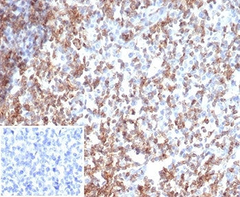 IHC staining of FFPE human tonsil tissue with recombinant CD2 antibody (clone rLFA2/7147). Negative 