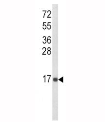 IL-8 Antibody