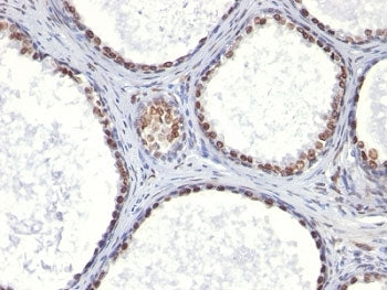 Androgen Receptor Antibody