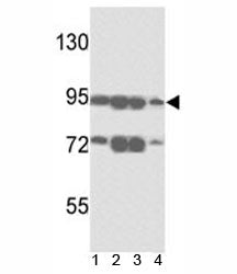 Western blot analysis of ABCB5 antibody and 1) A375, 2) K562, 3) A2058 and4) HL-60 lysate. Predicted