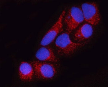 SUCLA2 Antibody / Succinyl-CoA synthetase beta-A chain