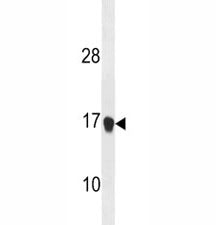 p21 Antibody