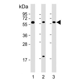 Western blot testing of human 1) HepG2, 2) K562 and 3) Raji cell lysate using TGFB1 antibody. Predic