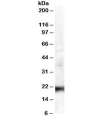 Western blot testing of A431 lysate with HP1 gamma antibody at 0.3ug/ml. Predicted molecular weight 