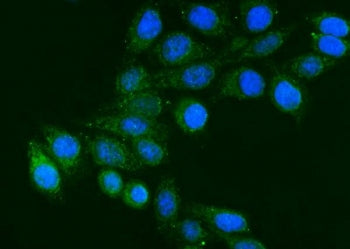 FGG Antibody / Fibrinogen gamma chain / FIBG