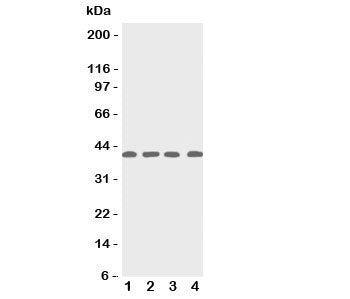 Western blot testing of p53R2 antbody; Lane 1: rat thymus; 2: human MCF-7; 3: (h) A431; 4: (h) HeLa 