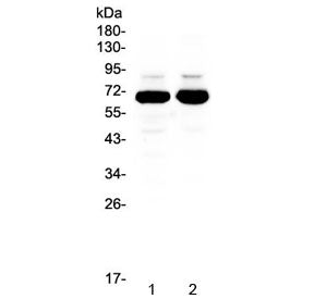 Western blot testing of 1) rat brain and 2) mouse brain lysate with SF1 antibody at 0.5ug/ml. Predic
