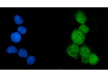 EEF2K Antibody / Eukaryotic elongation factor 2 kinase