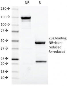 Estrogen Receptor alpha Antibody