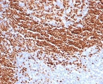 IHC staining of FFPE human tonsil tissue with SOX11 antibody (clone SOX11/7236). HIER: boil tissue s