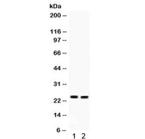 Lipocalin 2 Antibody / NGAL / LCN2