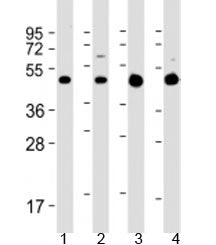 Western blot testing of 1) rat C6 cell lysate, 2) human SH-SY5Y cell lysate, 3) human brain lysate a