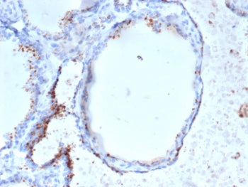 GAD65 Antibody / GAD2