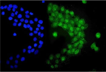 UBE1C Antibody / UBA3