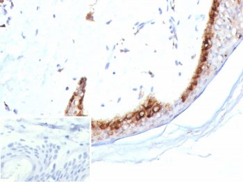 IHC staining of FFPE human skin tissue with Kallikrein 4 antibody (clone KLK4/8942). HIER: boil tiss