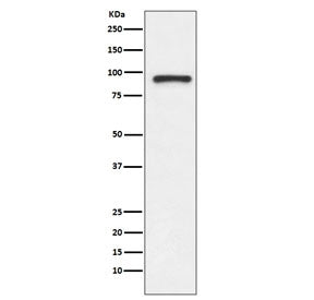 Western blot testing of human Jurkat cell lysate with TOP1 antibody. Expected molecular weight: 91-1