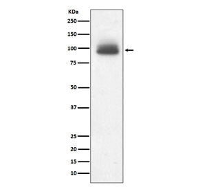 Glucocorticoid receptor Antibody / GR / NR3C1