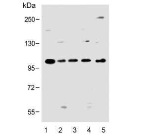 Western blot testing of human 1) SK-BR-3, 2) SH-SY5Y, 3) MCF7, 4) HL60 and 5) rat C6 cell lysate wit