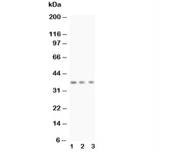 Western blot testing of BDNF antibody and Lane 1: rat brain; 2: mouse brain; 3: MCF-7; Predicted siz