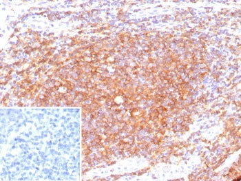IHC staining of FFPE human tonsil tissue with recombinant CD40 antibody (clone C40/9225R). Inset: PB