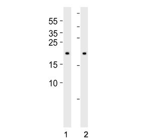 Western blot testing of human 1) 293 and 2) HT-1080 cell lysate with BAX antibody. Predicted molecul