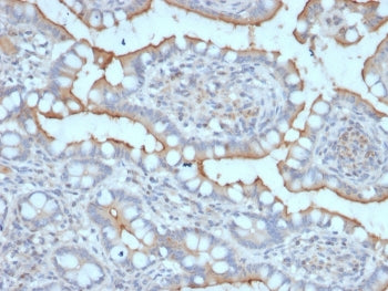IHC staining of FFPE human stomach with StAR antibody. HIER: boil tissue sections in pH 9 10mM Tris 