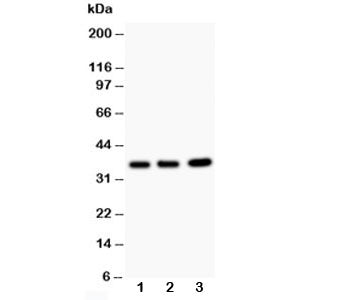 Western blot testing of TNFAIP1 antibody and Lane 1: rat thymus; 2: HeLa; 3: COLO320; Predicted size