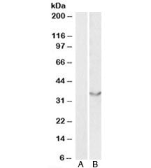 JAM2 Antibody