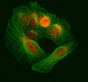 Immunofluorescent staining of FFPE human U-2 OS cells with U1-70K antibody (red) and Beta Tubulin mA
