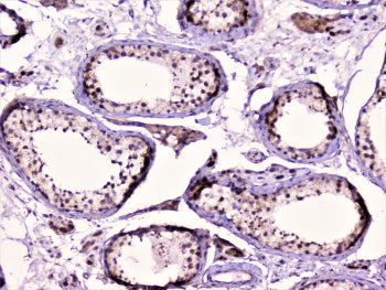IHC staining of FFPE human testis with RAD51 antibody at 1ug/ml. HIER: boil tissue sections in pH6, 