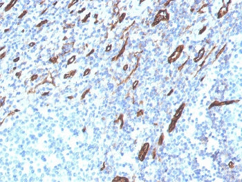 IHC staining of FFPE human tonsil with CD31 antibody (clone PECAM1/3525). HIER: boil tissue sections