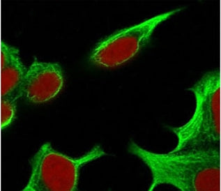 Immunofluorescent staining of PFA-fixed human HepG2 cells with TNF-alpha antibody (green, clone TMDa
