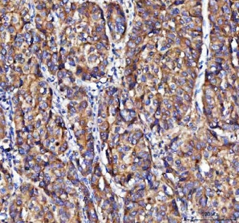 MOAP1 Antibody / MAP-1 / Modulator of apoptosis 1
