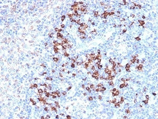 IHC staining of FFPE human lymph node tissue with ZFP64 antibody (clone PCRP-ZFP64-1H2). HIER: boil 