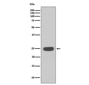 Interferon gamma Antibody / IFNG